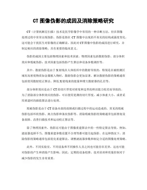 CT图像伪影的成因及消除策略研究