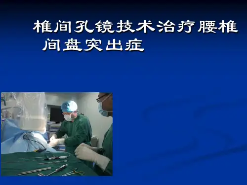 椎间孔镜入路