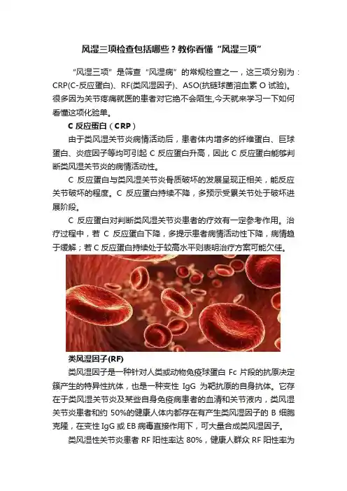风湿三项检查包括哪些？教你看懂“风湿三项”