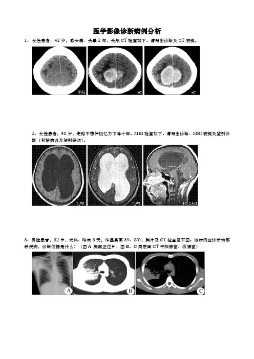 医学影像诊断病例分析