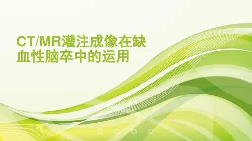 灌注成像PPT课件
