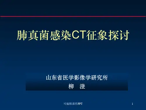 肺真菌CT诊断ppt课件