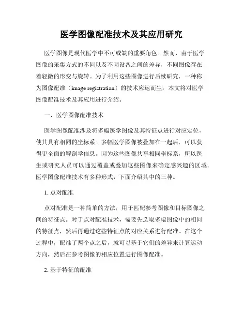 医学图像配准技术及其应用研究
