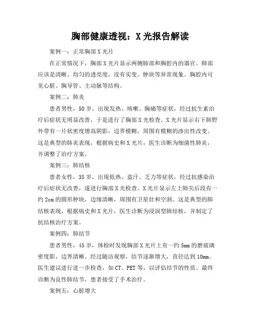 胸部健康透视：X光报告解读