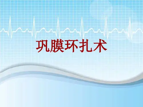 手术讲解模板：巩膜环扎术