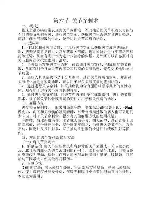 关节穿刺术