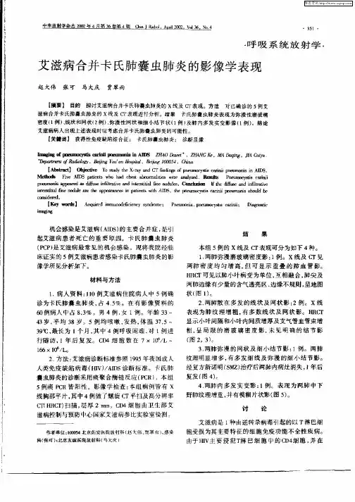 艾滋病合并卡氏胶囊虫肺炎的影像学表现