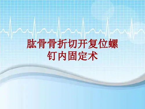 外科手术教学资料：肱骨骨折切开复位螺钉内固定术讲解模板