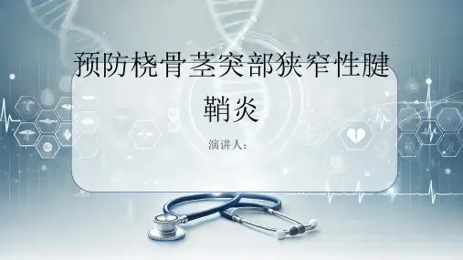 预防桡骨茎突部狭窄性腱鞘炎