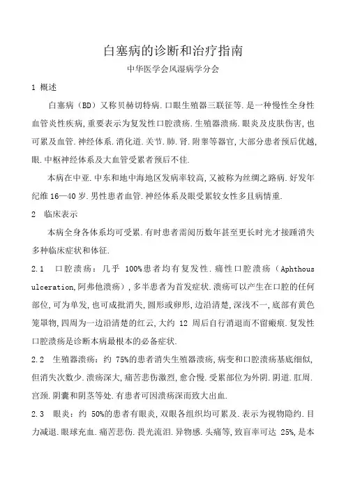 白塞病的诊断和治疗指南