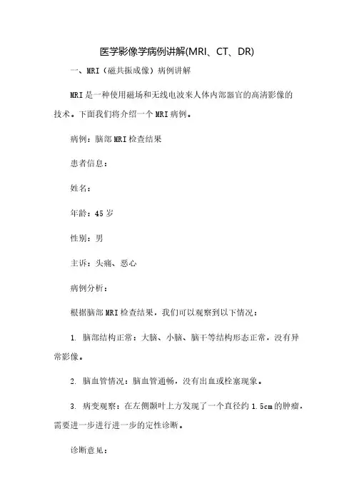 医学影像学病例讲解(MRI、CT、DR)