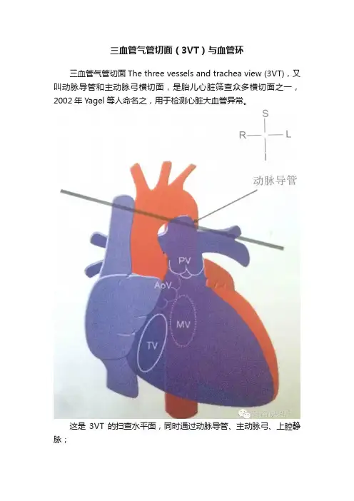 三血管气管切面（3VT）与血管环