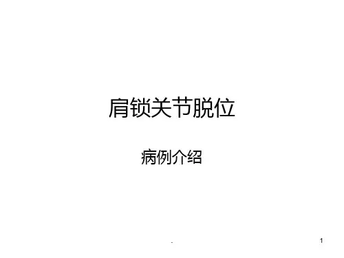 肩锁关节脱位PPT课件