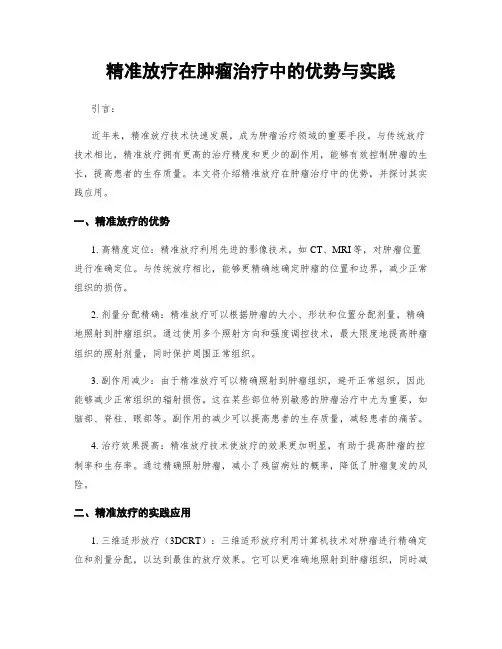 精准放疗在肿瘤治疗中的优势与实践