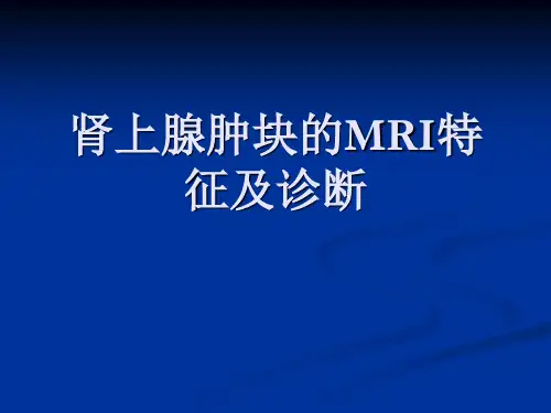 肾上腺肿块的MRI特征及诊断