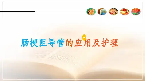 肠梗阻导管的临床应用及护理