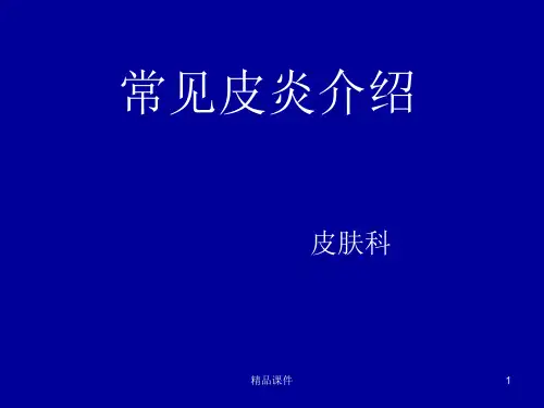 常见皮炎介绍PPT课件