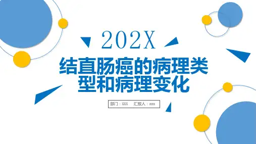 结直肠癌的病理类型和病理变化