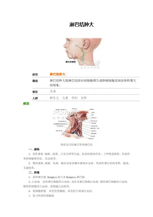 淋巴结肿大