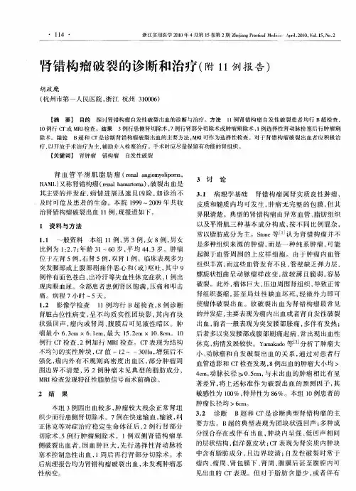 肾错构瘤破裂的诊断和治疗(附11例报告)
