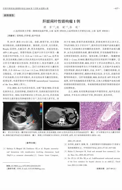 肝脏间叶性错构瘤1例