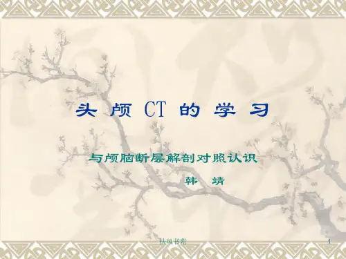 头颅CT与断层解剖对照[业界特制]