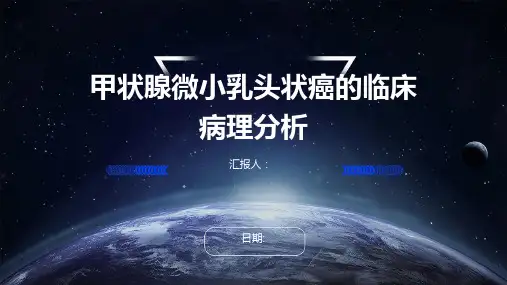 甲状腺微小乳头状癌的临床病理分析