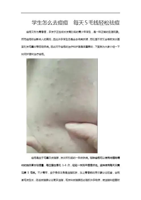 学生怎么去痘痘  每天5毛钱轻松祛痘