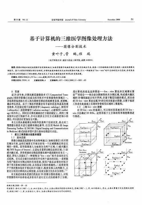 基于计算机的三维医学图像处理方法——图像分割技术