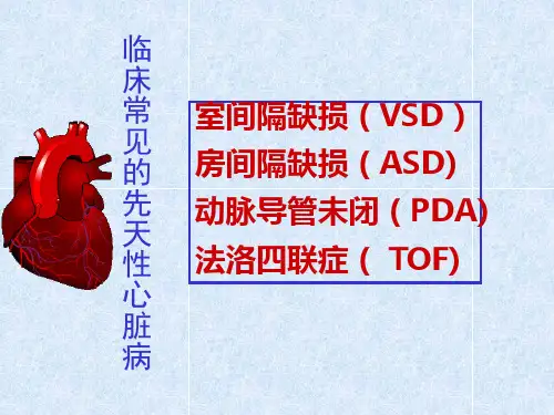 常见的几种先心病_new