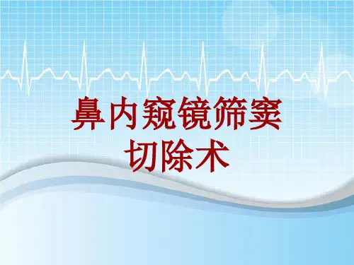 手术讲解模板：鼻内窥镜筛窦切除术