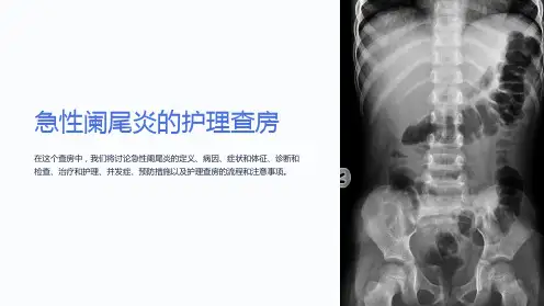 急性阑尾炎的护理查房