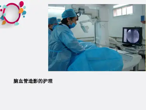 《脑血管造影》PPT课件