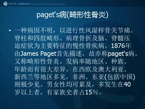 paget's病