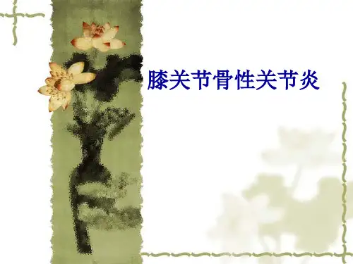 膝关节骨性关节炎精品PPT课件