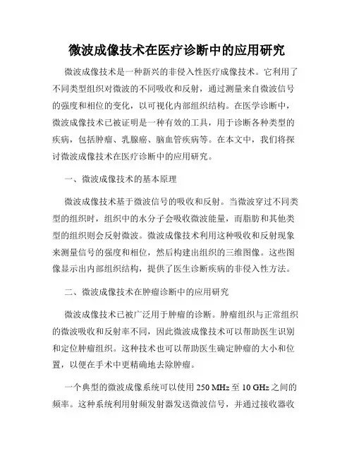 微波成像技术在医疗诊断中的应用研究