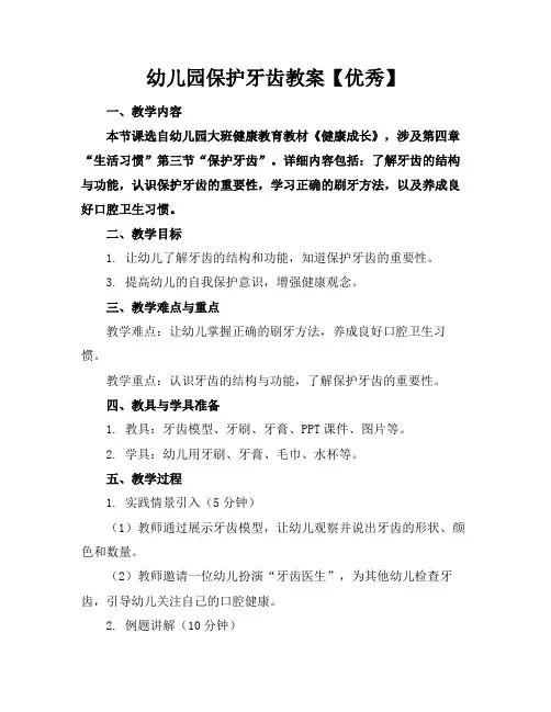 幼儿园保护牙齿教案【优秀】