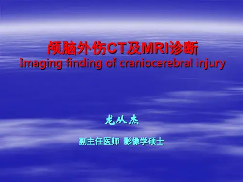 颅脑外伤CT及MRI诊断