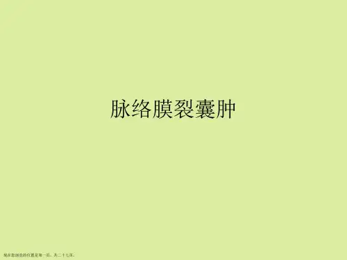 脉络膜裂囊肿