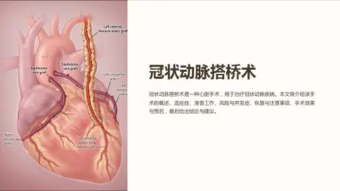 冠状动脉搭桥术