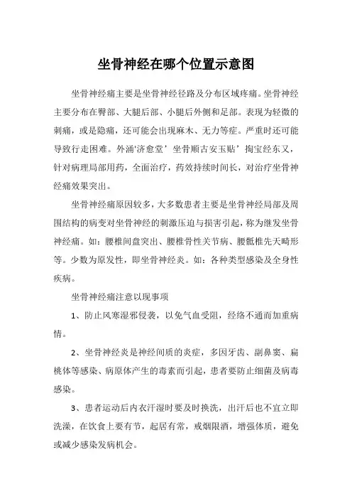 坐骨神经在哪个位置示意图