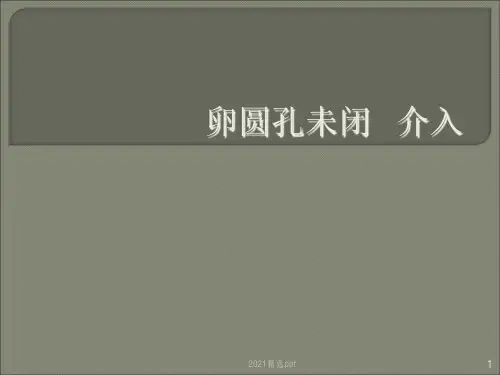 卵圆孔未闭介入ppt课件