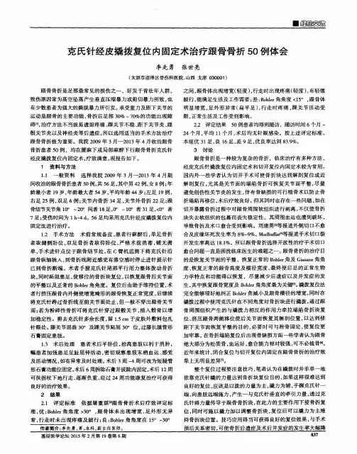 克氏针经皮撬拨复位内固定术治疗跟骨骨折50例体会