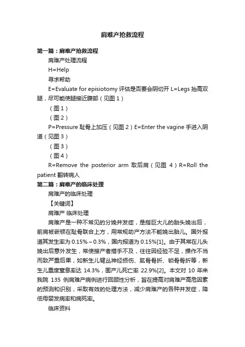 肩难产抢救流程