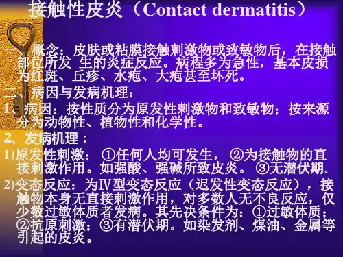 接触性皮炎