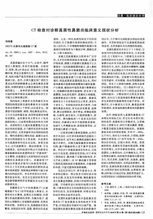 CT检查对诊断真菌性鼻窦炎临床意义现状分析
