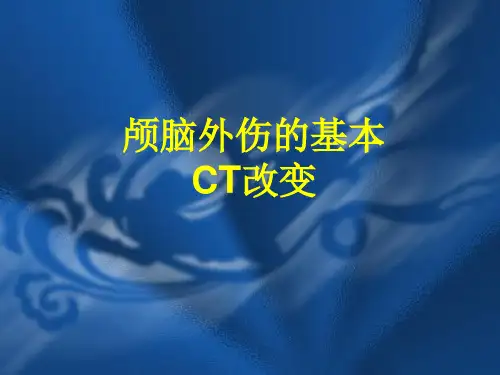 颅脑外伤的基本CT改变