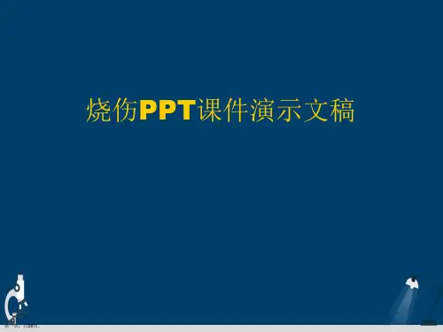 烧伤PPT课件演示文稿