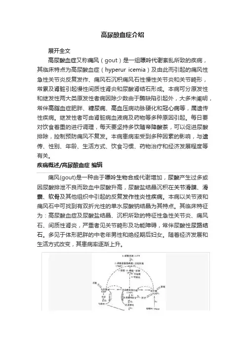 高尿酸血症介绍