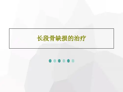 长段骨缺损的治疗33页PPT